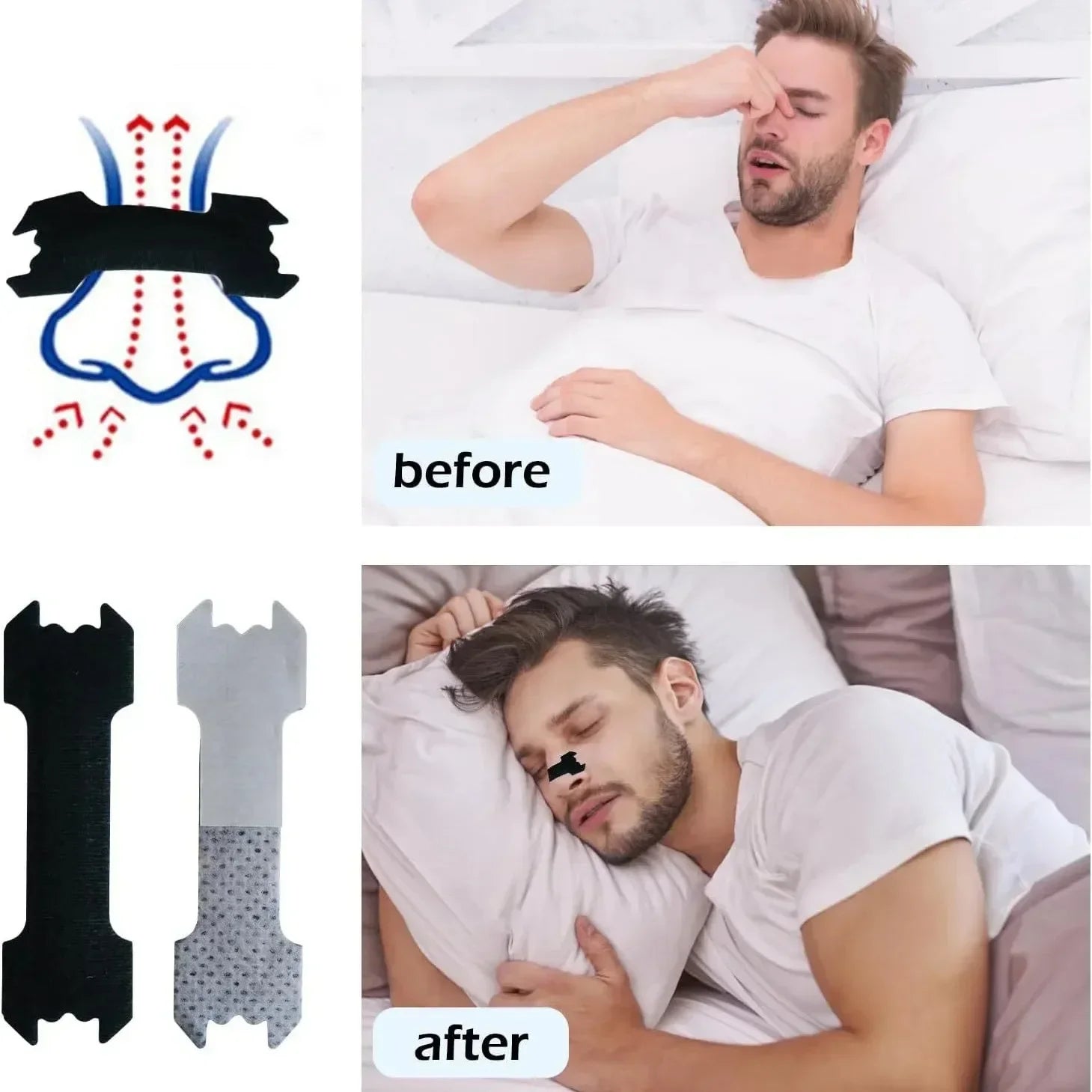Anti-Snoring Nasal Strips Set
