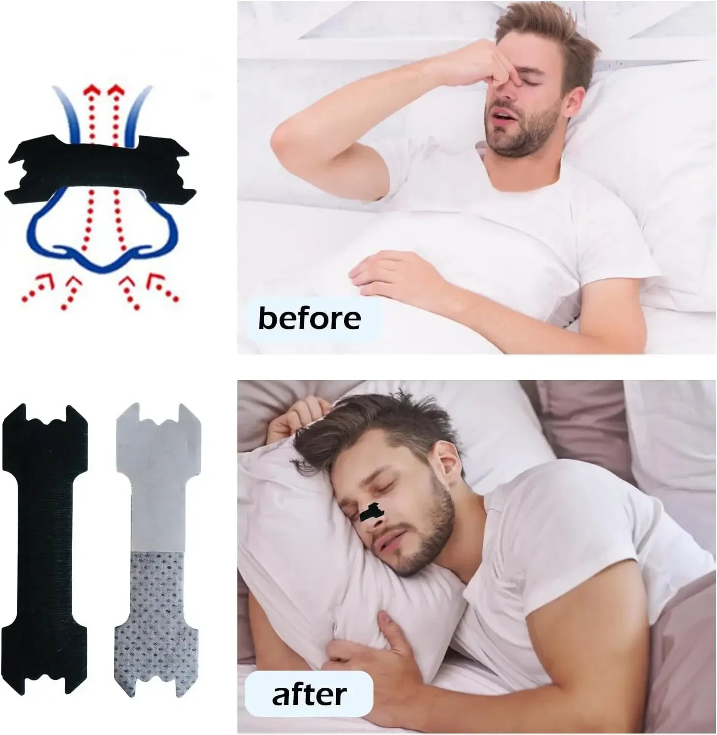 Anti-Snoring Nasal Strips Set