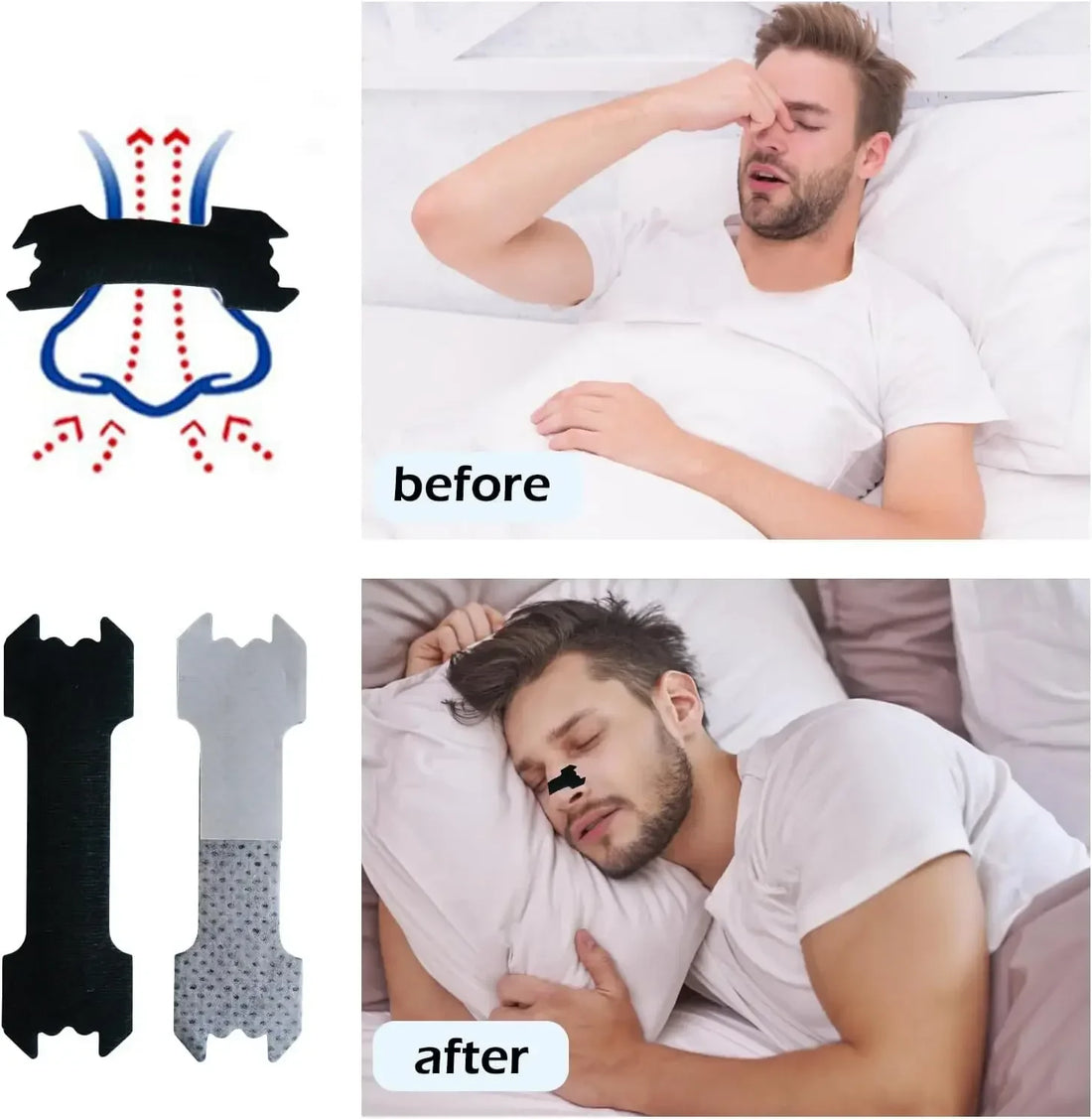 Anti-Snoring Nasal Strips Set