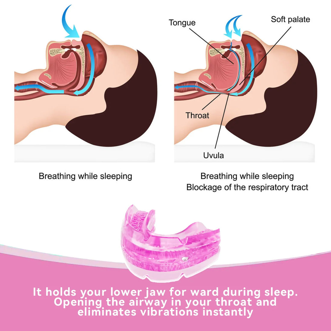 Anti-Snore Bruxism Mouth Guard