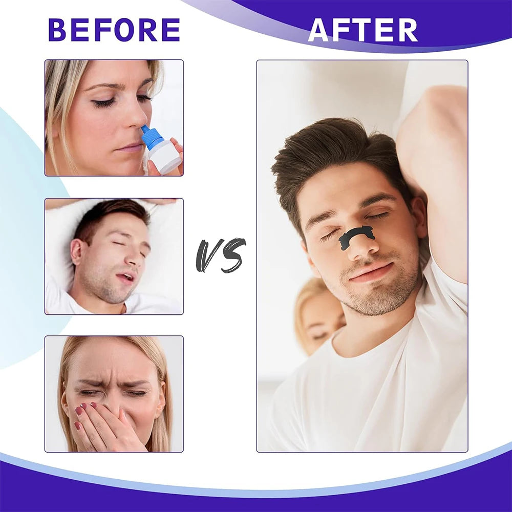 Black Anti-Snoring Nose Strips