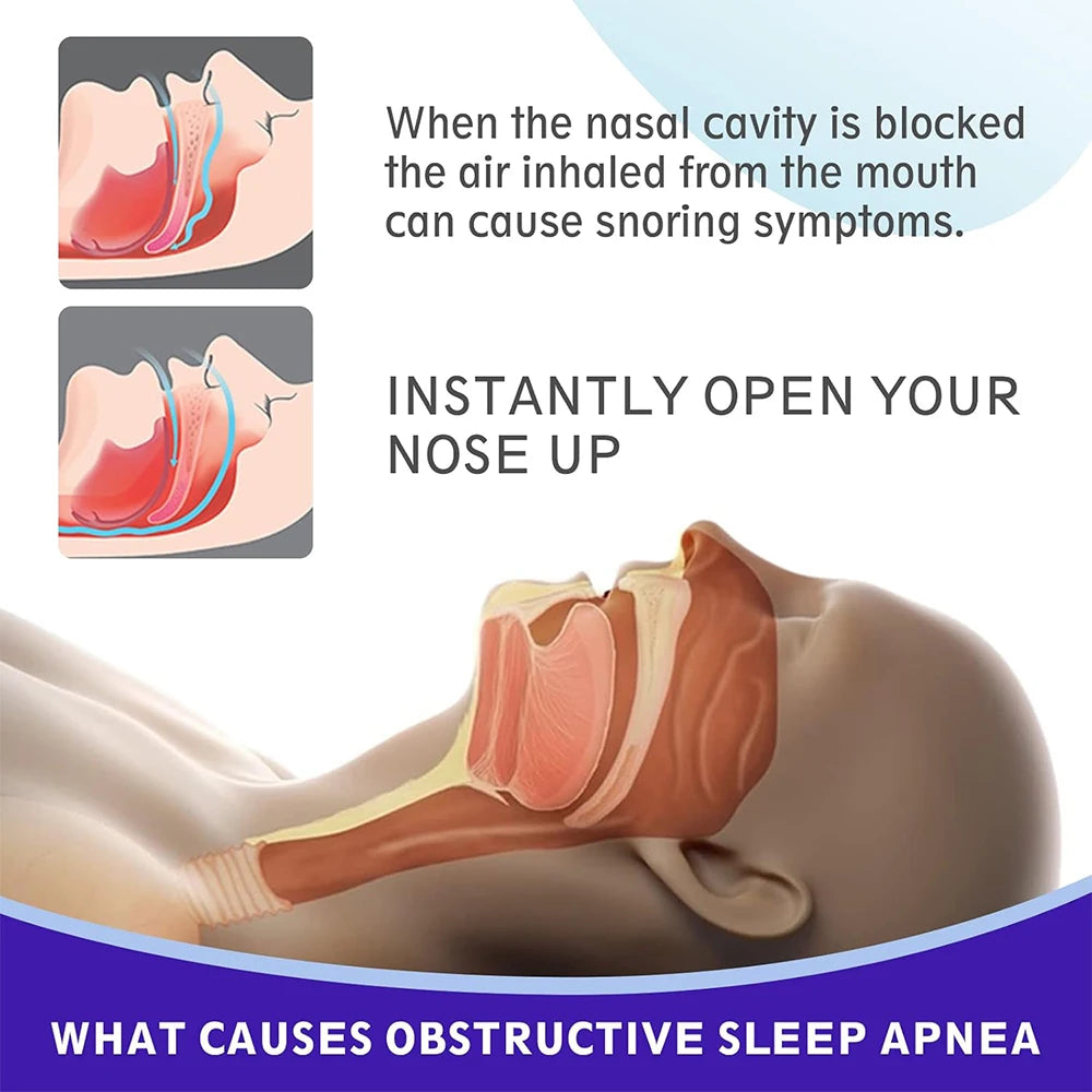 Black Anti-Snoring Nose Strips